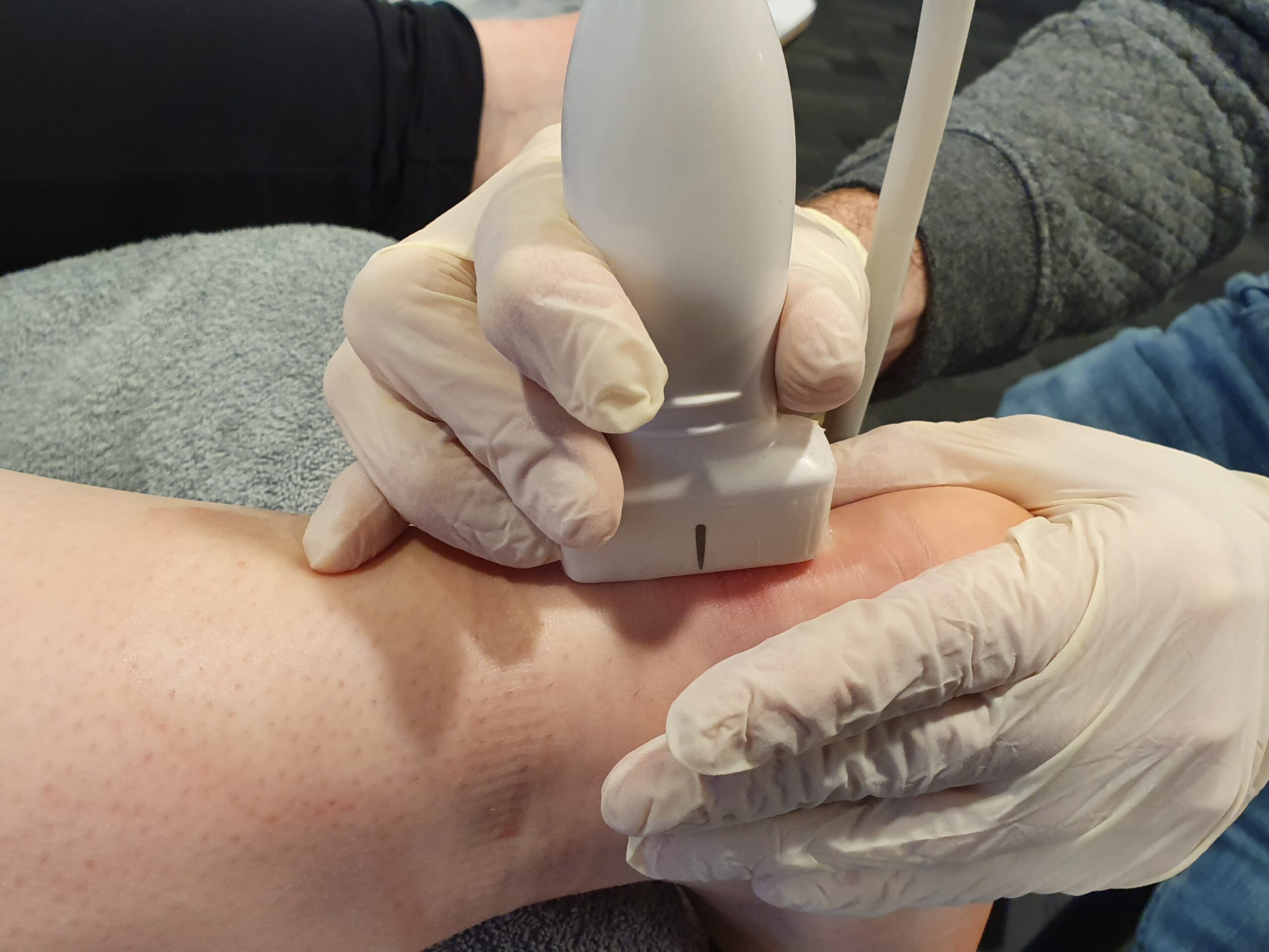 EPTE Percutane - header afbeelding